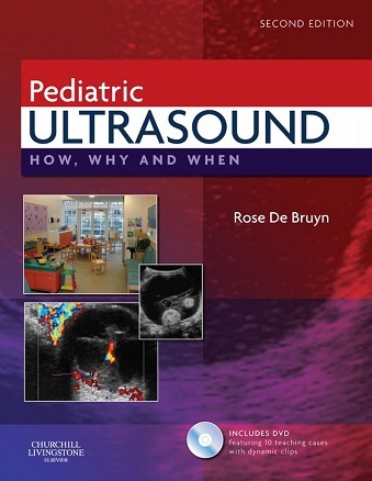 Pediatric ultrasound how why and when