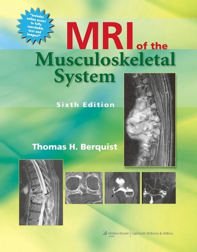 MRI of the musculoskeletal system