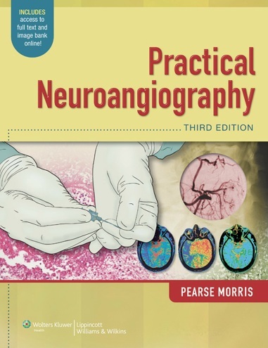 Practical neuroangiography 3rd