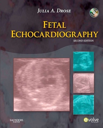 Fetal Echocardiography 2