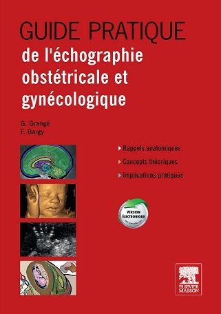 Guide Pratique de LEchographie Obstetricale Et Gynecologique