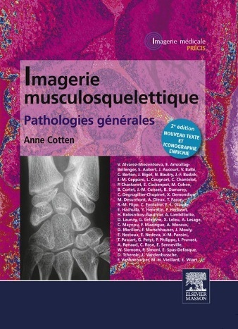 Imagerie musculosquelettique Pathologies générales