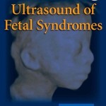 Ultrasound of Fetal Syndromes, 2e