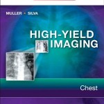 High-Yield Imaging: Chest