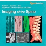 Imaging of the Spine: Expert Radiology Series, Expert Consult-Online and Print, 1e