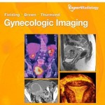 Gynecologic Imaging: Expert Radiology Series, 1e