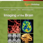 Imaging of the Brain: Expert Radiology Series, 1e