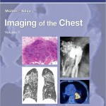 Imaging of the Chest, 2-Volume Set