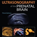 Ultrasonography of the Prenatal Brain, 3rd Edition