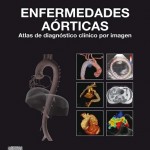 Enfermedades aórticas: Atlas de diagnóstico clínico por imagen