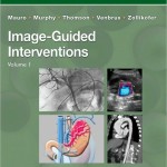 Image-Guided Interventions: Expert Radiology Series, 1e