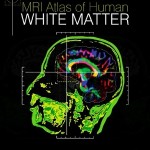 MRI Atlas of Human White Matter, Second Edition