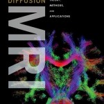 Diffusion MRI: Theory, Methods, and Applications
