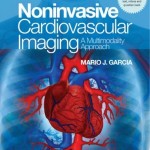 NonInvasive Cardiovascular Imaging: A Multimodality Approach Retail PDF