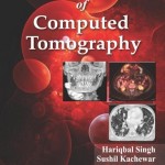 Practical Atlas of Computed Tomography