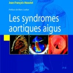 Syndromes aortiques aigus