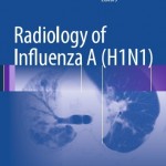 Radiology of Influenza A (H1N1)