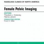 Female Pelvic Imaging, An Issue of Radiologic Clinics of North America