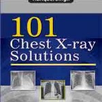 101 Chest X-ray Solutions