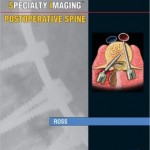 Specialty Imaging: Postoperative Spine: Published by Amirsys