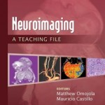 Neuroimaging: A Teaching File Retail PDF