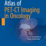 Atlas of PET-CT Imaging in Oncology: A Case-Based Guide to Image Interpretation