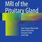 MRI of the Pituitary Gland 2016