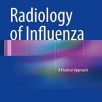 Radiology of Influenza 2016 : A Practical Approach
