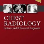 Chest Radiology : Patterns and Differential Diagnoses