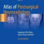 Atlas of Postsurgical Neuroradiology : Imaging of the Brain, Spine, Head, and Neck