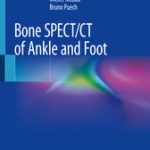 Bone SPECT/CT of Ankle and Foot
