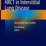 HRCT in Interstitial Lung Disease : Instructive Case Studies