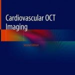 Cardiovascular OCT Imaging
