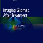 Imaging Gliomas After Treatment : A Case-based Atlas