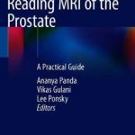 Reading MRI of the Prostate : A Practical Guide