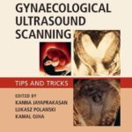 Gynaecological Ultrasound Scanning : Tips and Tricks