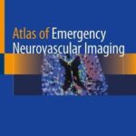 Atlas of Emergency Neurovascular Imaging