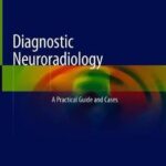 Diagnostic Neuroradiology : A Practical Guide and Cases