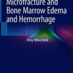 Imaging of Trabecular Microfracture and Bone Marrow Edema and Hemorrhage