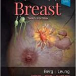 Diagnostic Imaging: Breast